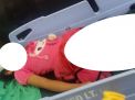 Kepala Lubang 5 CM, Anak 6 Tahun Jadi Korban Jambret di Jalan Tidar