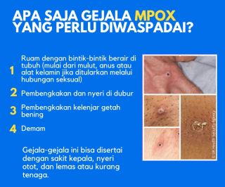 Cegah Penularan Mpox, Pemkot Surabaya Masifkan Sosialisasi PHBS
