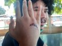 Pelaku Pengeroyok Editor detikcom Belum Tertangkap, Ini Alasan Polisi