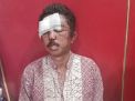 Pelaku Curanmor yang Dihajar Massa Siuman, Polisi: Dia Residivis