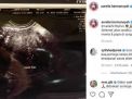 Diduga Kelelahan, Aurel Hermansyah Keguguran