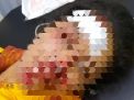 Pulang Malam, Gadis Ini Jadi Korban Keganasan Pemuda Mabuk di Surabaya