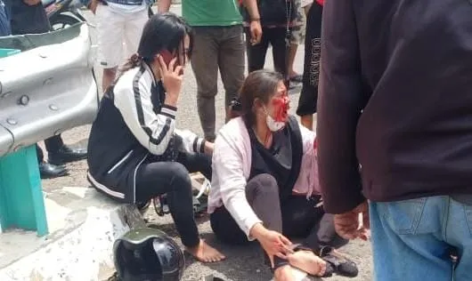 Jadi Korban Jambret, Anjani dan Nadya Terjatuh Tabrak Pembatas Jalan