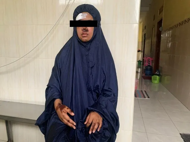 Begini Kronologi Lengkap Gadis yang Jadi Korban Keganasan Pemuda Mabuk