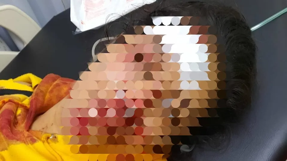 Pulang Malam, Gadis Ini Jadi Korban Keganasan Pemuda Mabuk di Surabaya