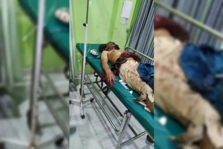 Asyik Merakit Mercon, Satu Warga di Jombang Tewas Terkena Ledakan
