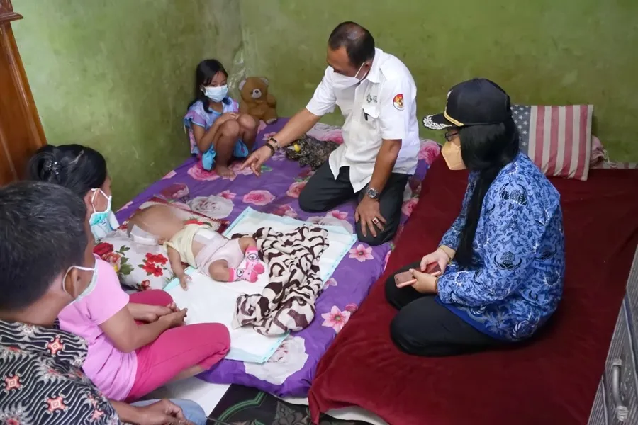 Pemkot Surabaya Gercep Tangani Elora, Bayi Penderita Hidrosefalus di Gadukan Morokrembangan