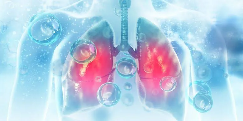 Alami Peningkatan, 8.080 Balita Di Surabaya Terjangkit Pneumonia