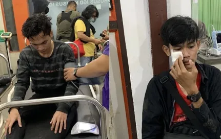 Demo Jilid III Di Kantor Gubernur, Tiga Mahasiswa Babak Belur Dilarikan Ke IGD