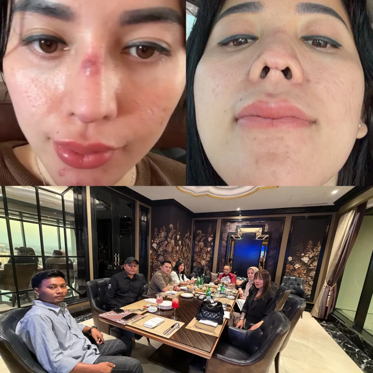 MAHAKARYA MALPRAKTIK: Ketika Hidung Menjadi Kanvas Eksperimen dan Daun Telinga Jadi Tumbal Arsitektur Apartemen
