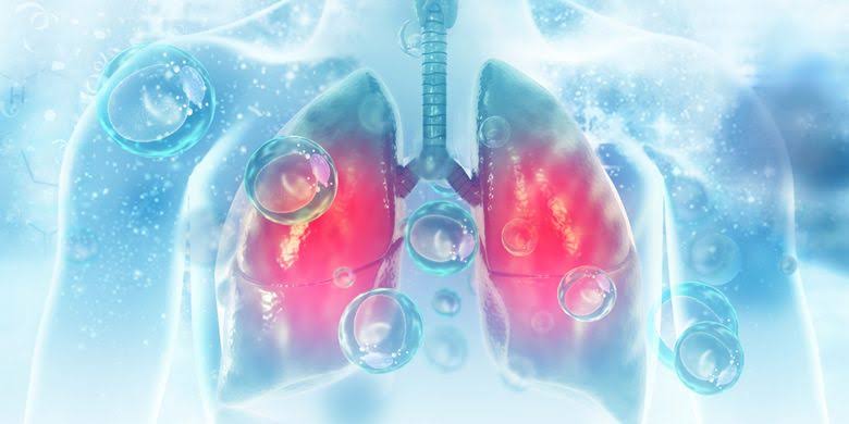 Ilustrasi Pneumonia