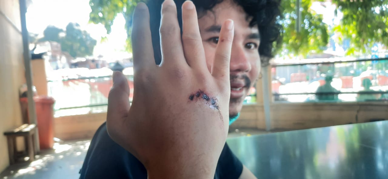 Jurnalis detikcom Suki yang menjadi korban pengeroyokan di Surabaya