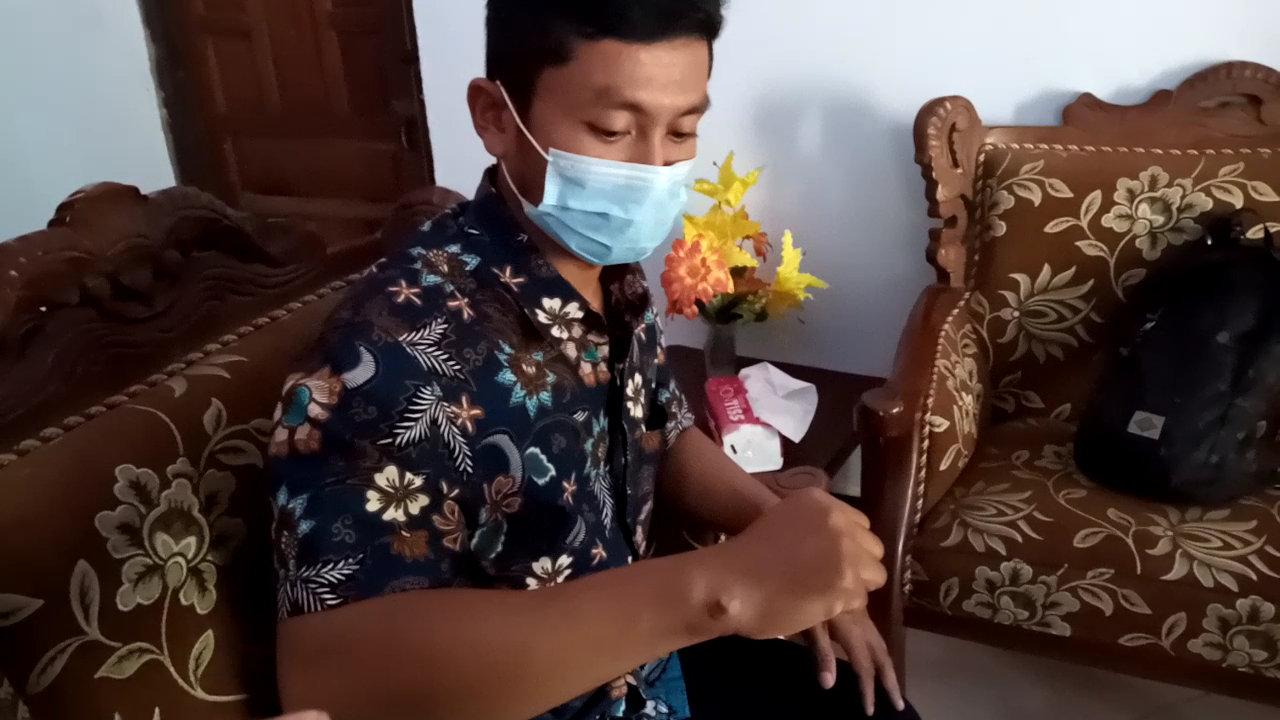 Agung Aris Saputra tunjukan luka bekas anthrax di tangan kanannya.