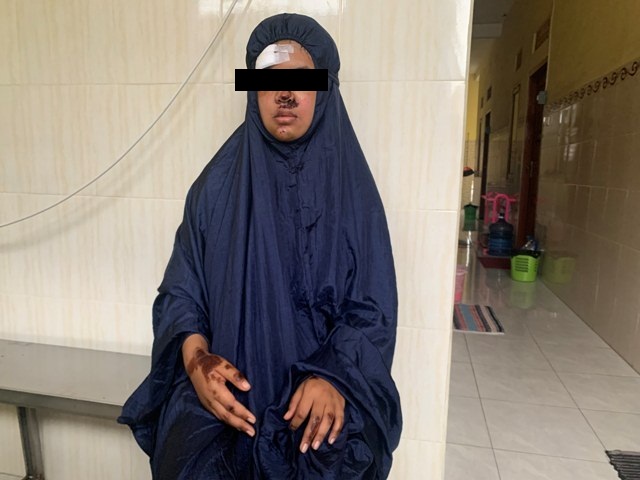 Kondisi Wulan yang saat ini menjalani masa pemulihan setelah jadi korban penjambretan.