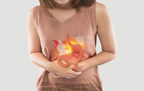 Ilustrasi asam lambung (Foto: Eka Hospital)